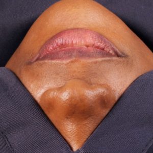 Dentist Face Drapes  –  Only sold in quantities of 20